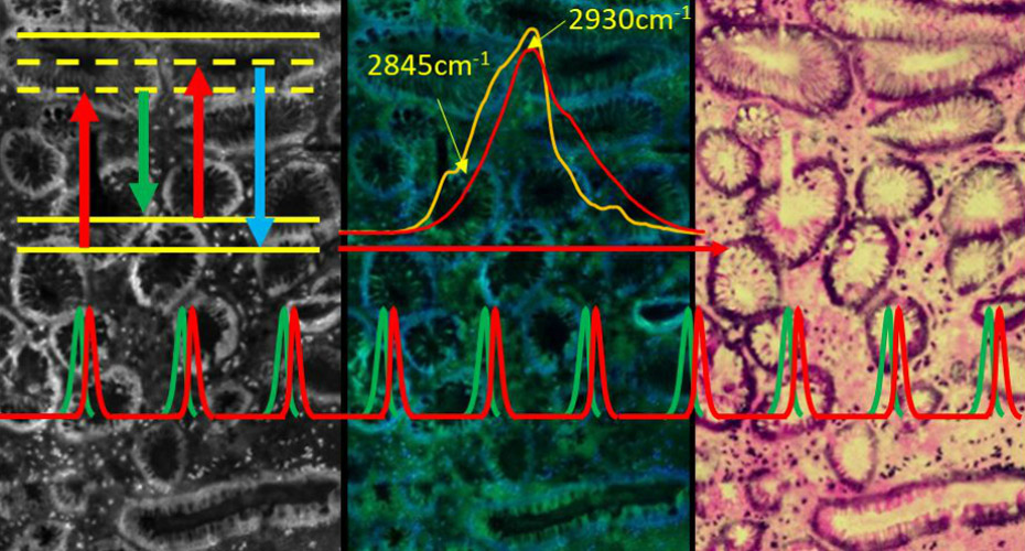Set of graphs and images illustrating coherent Raman scattering