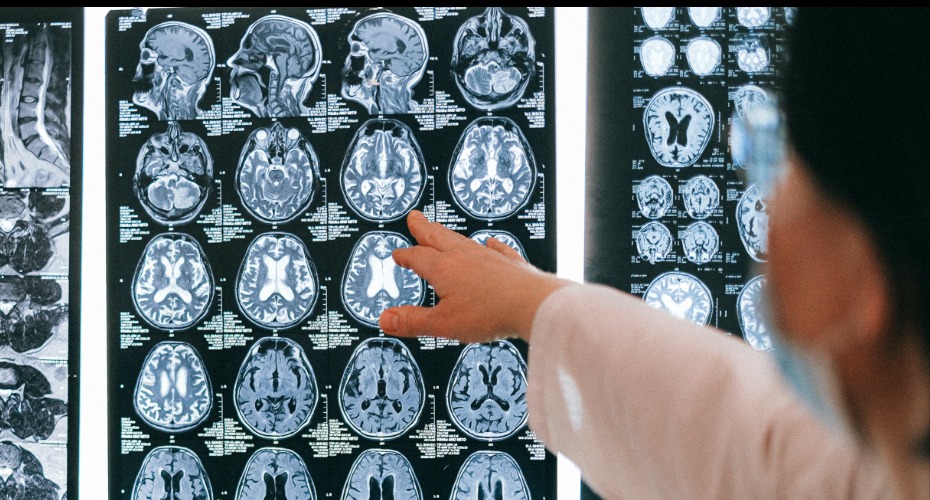 brain scans