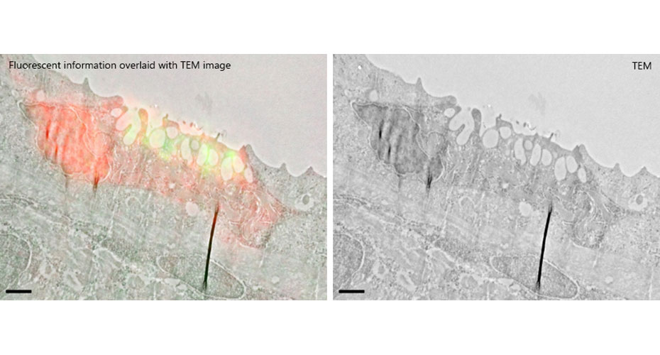 Correlative Light and Electron Microscopy (CLEM)  techniques