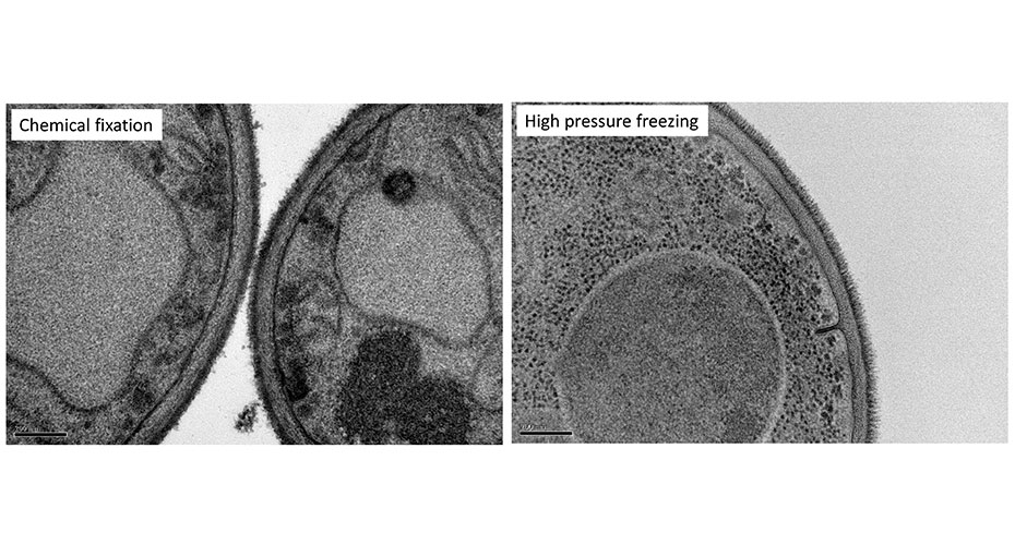 TEM techniques Freeze substitution